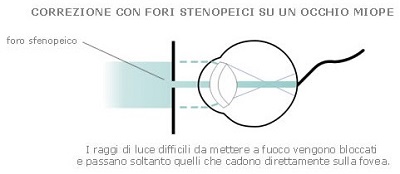 Bio Occhiali Stenopeici benefici